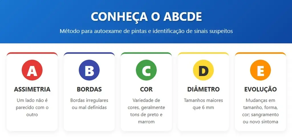 Infográfico mostrando o ABCDE sobre como tirar um nevo:
Assimetria, Bordas, Cor, Diâmetro e Evolução